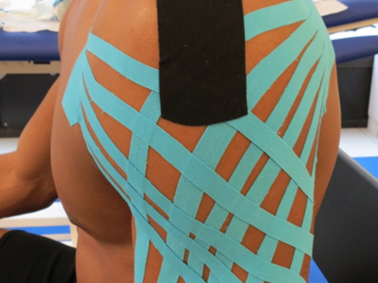 Kinesio taping
